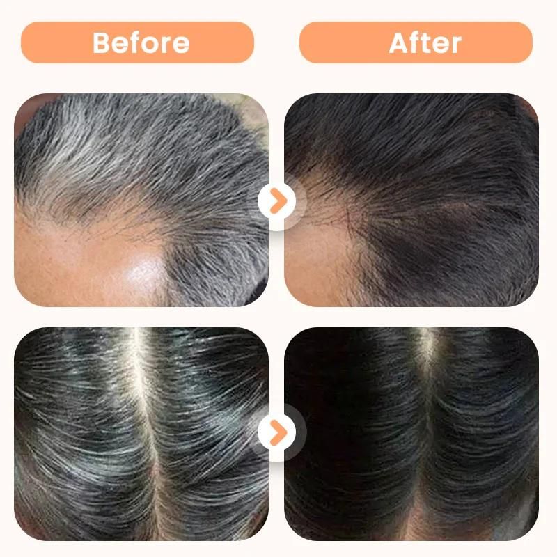 Plant Extract Hair Dye for Gray Hair 200 ml (Pack of 2)
